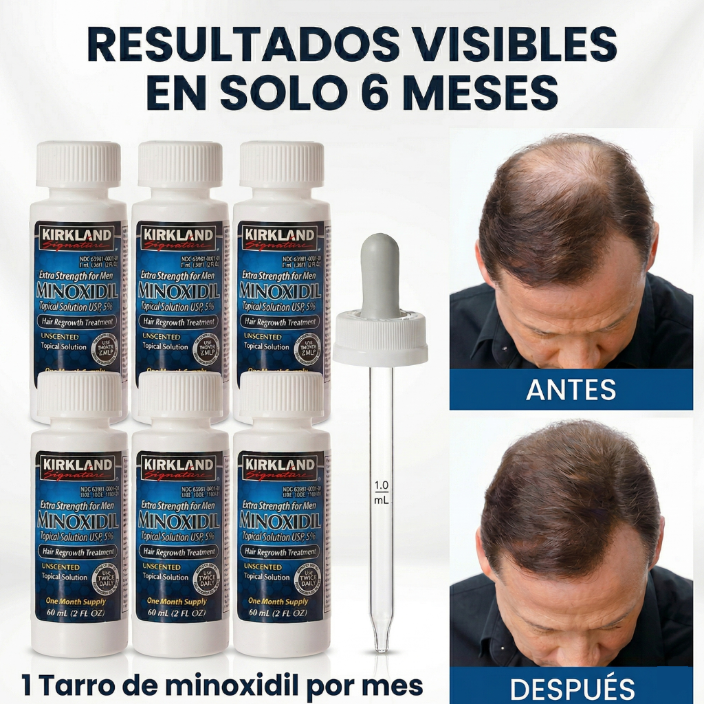 Minoxidil 5% Kirkland — Caja 6 Meses | Tratamiento Completo